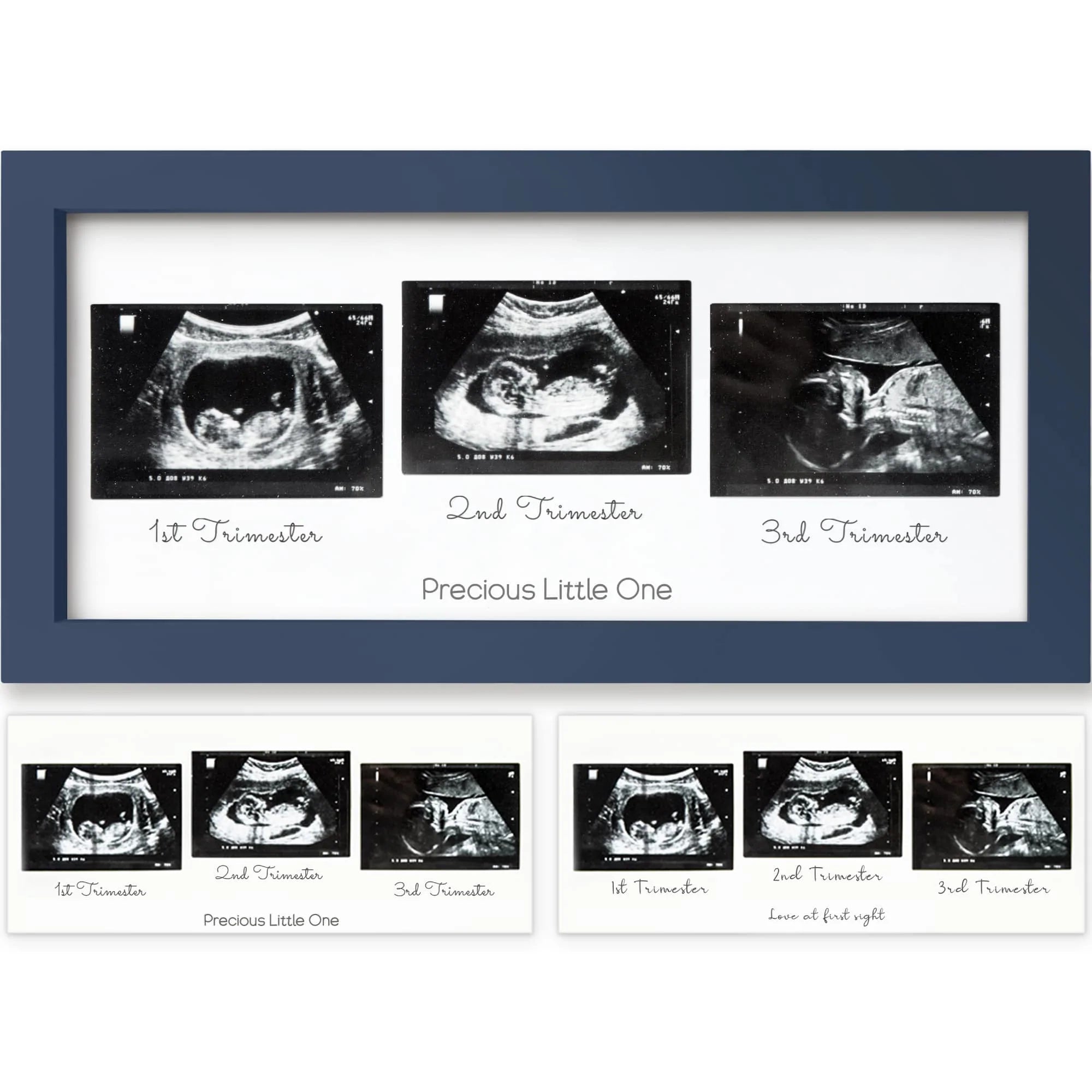 Baby Sonogram Picture Frame 3 Trimester Ultrasound Frames For New