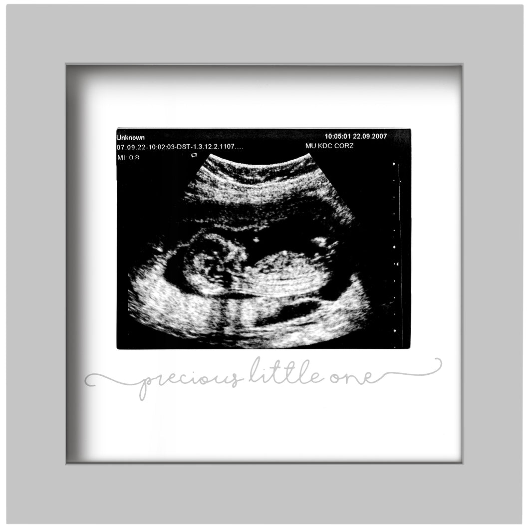 Solo Baby Sonogram Frame (Cloud Gray)