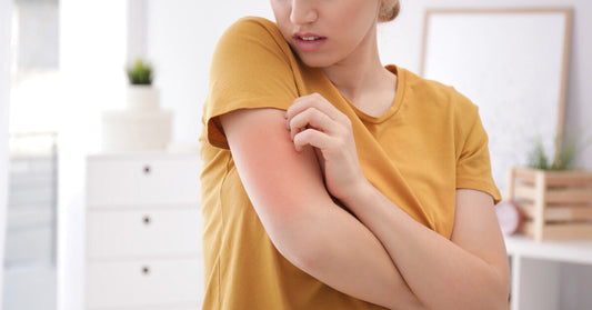 Postpartum Hives