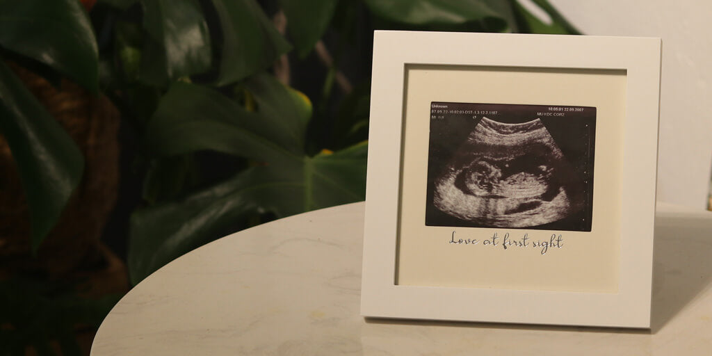 Fascinating fetal behavior