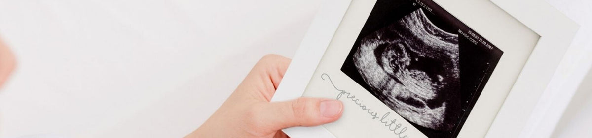 Sonogram Frames