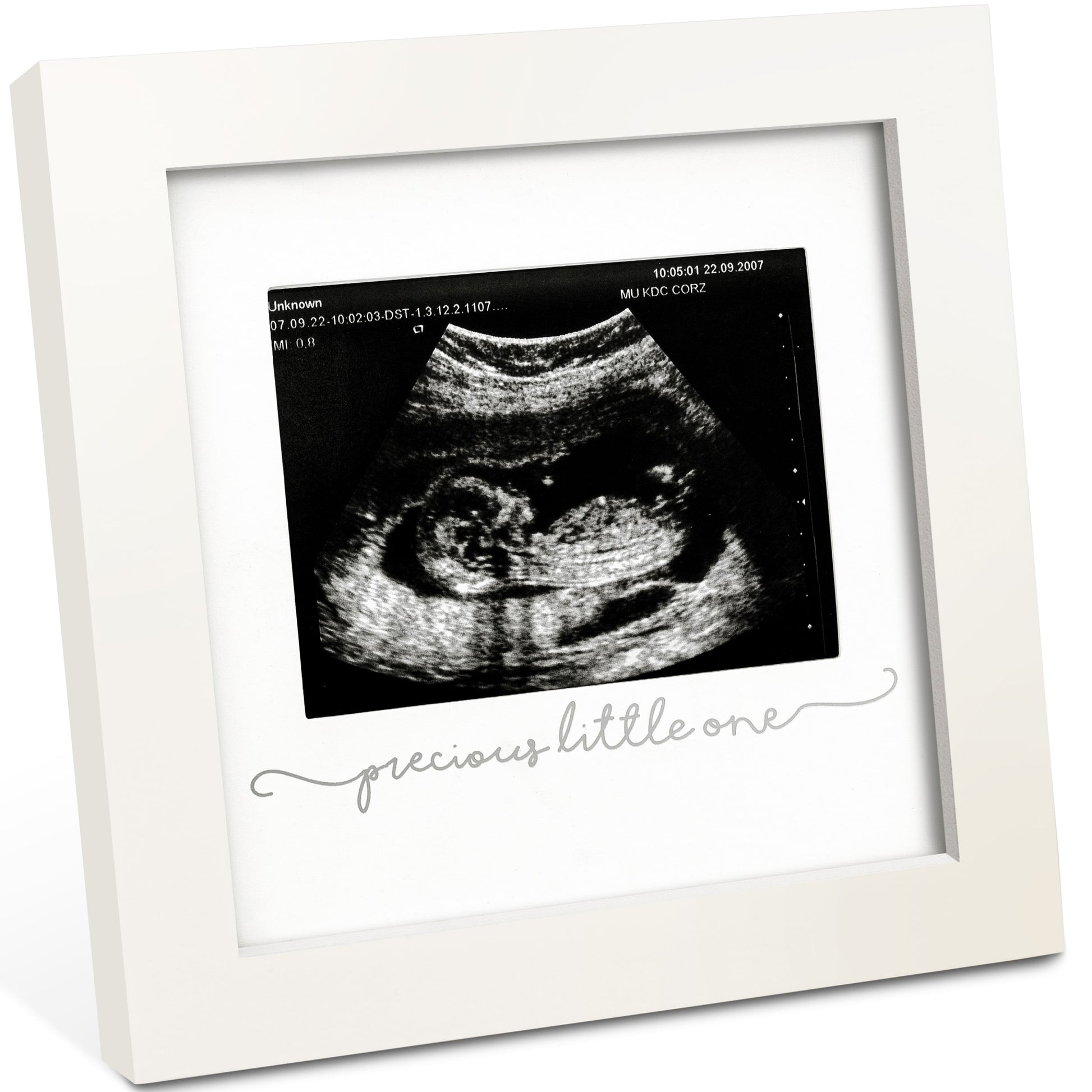 Solo Baby Sonogram Frame 27798492414138