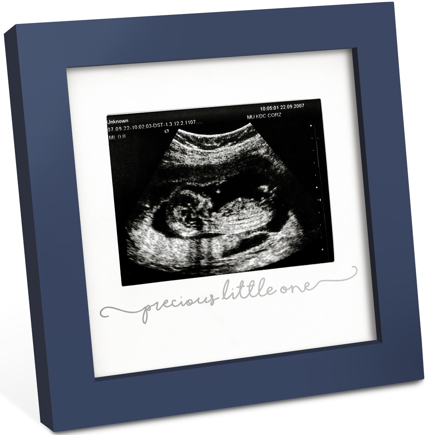 Solo Baby Sonogram Frame 27273225306298
