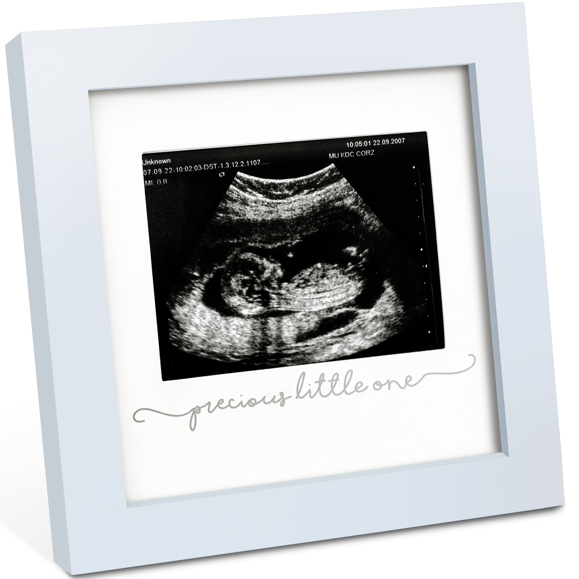 Solo Baby Sonogram Frame 27273225339066