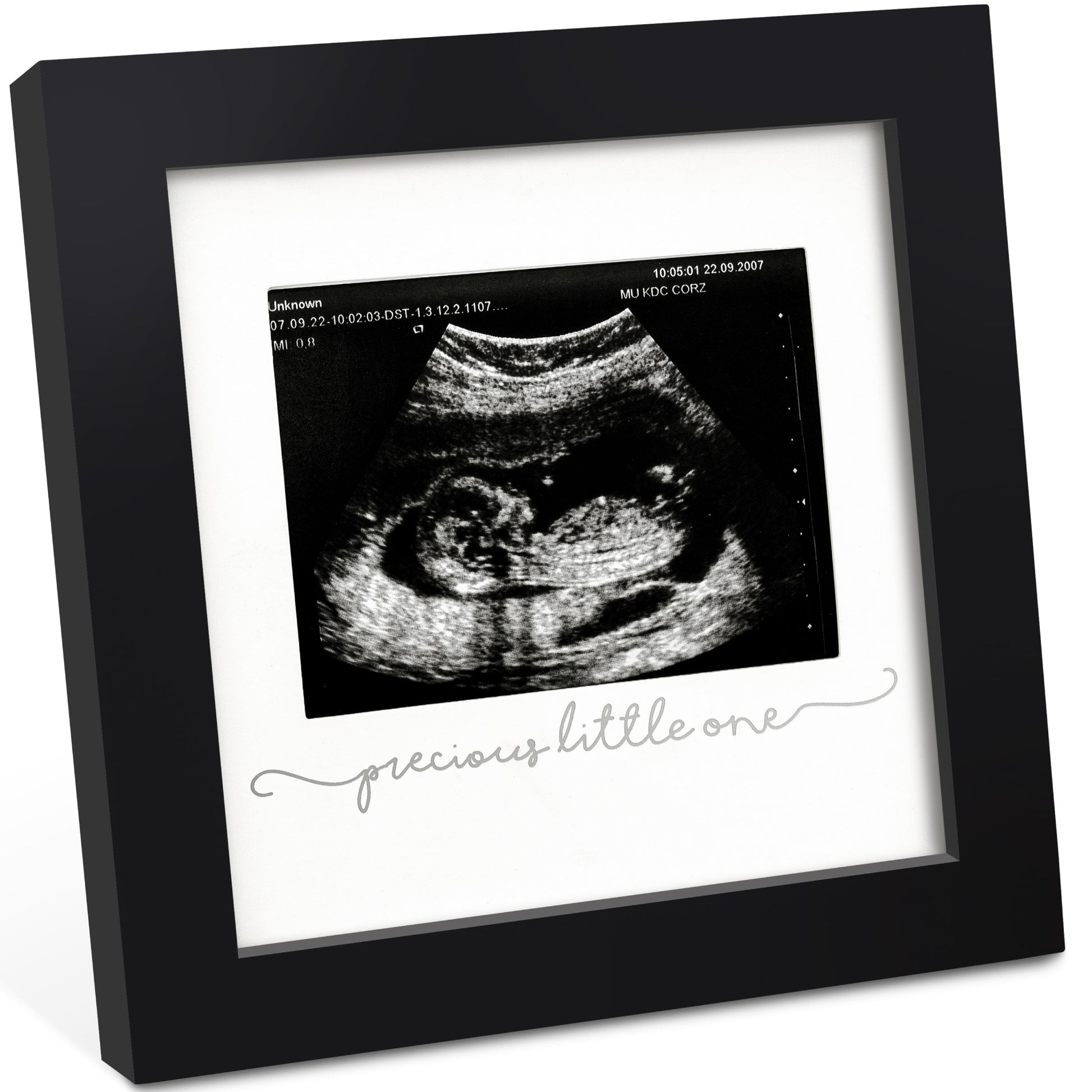 Solo Baby Sonogram Frame 27273225371834