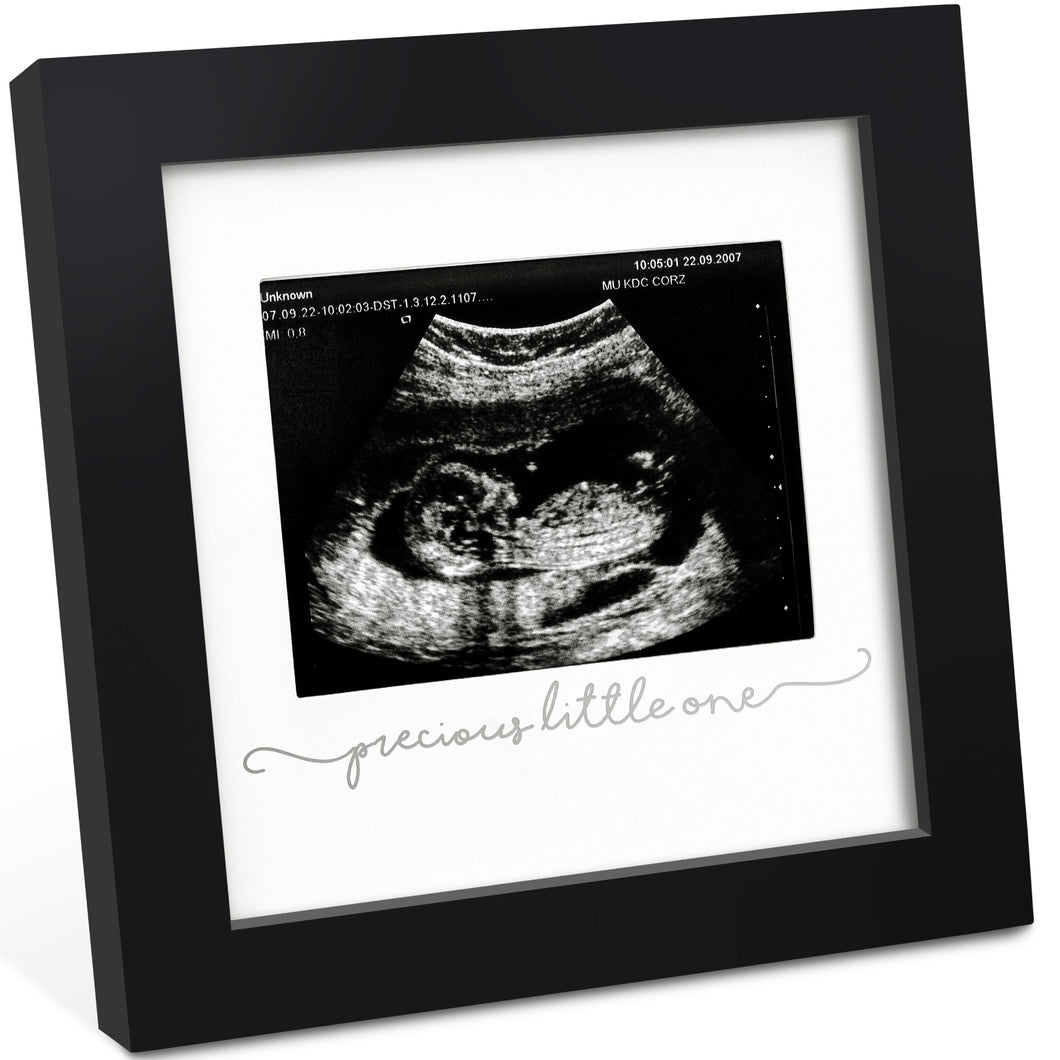 Solo Baby Sonogram Frame (Onyx Black)