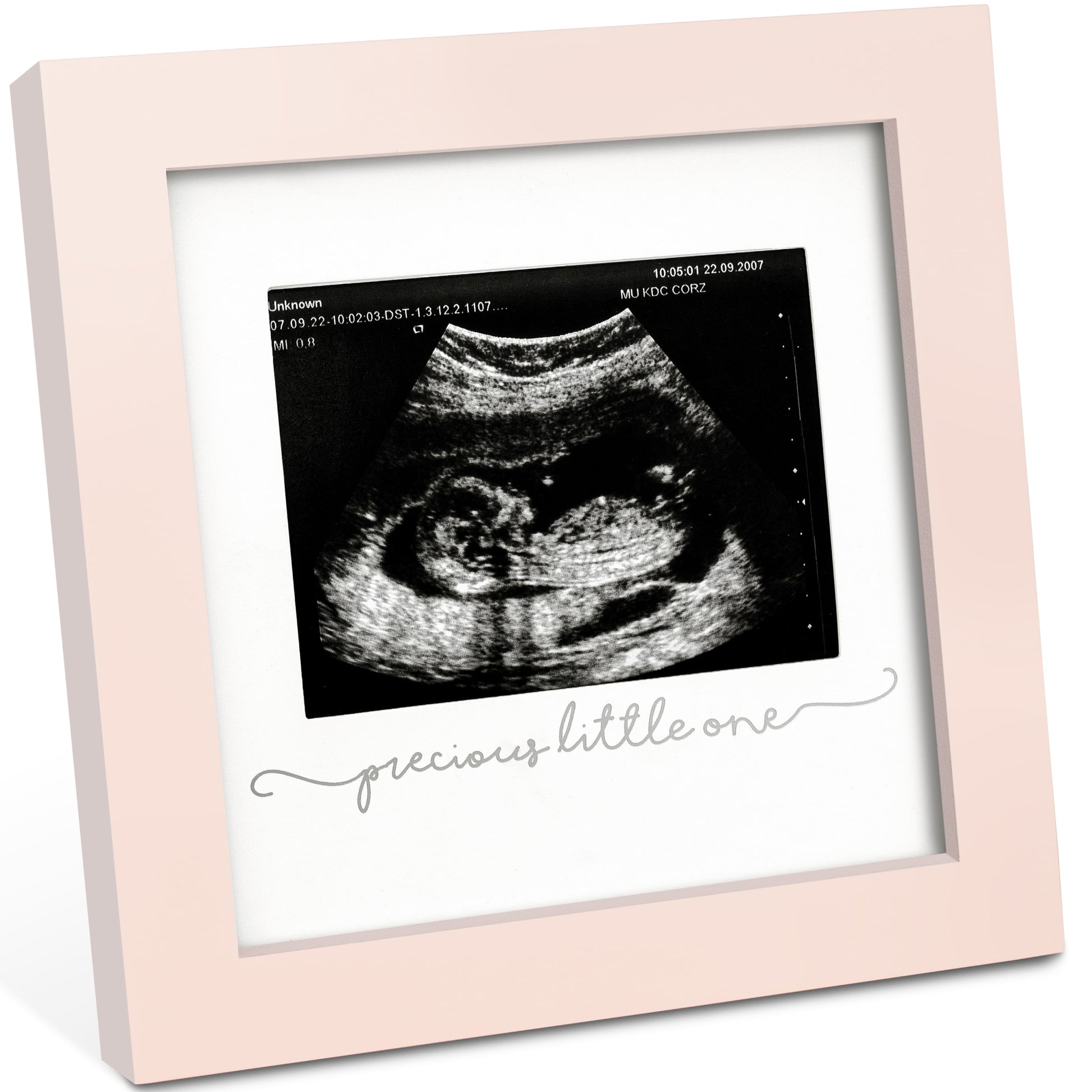 Solo Baby Sonogram Frame 27273225404602