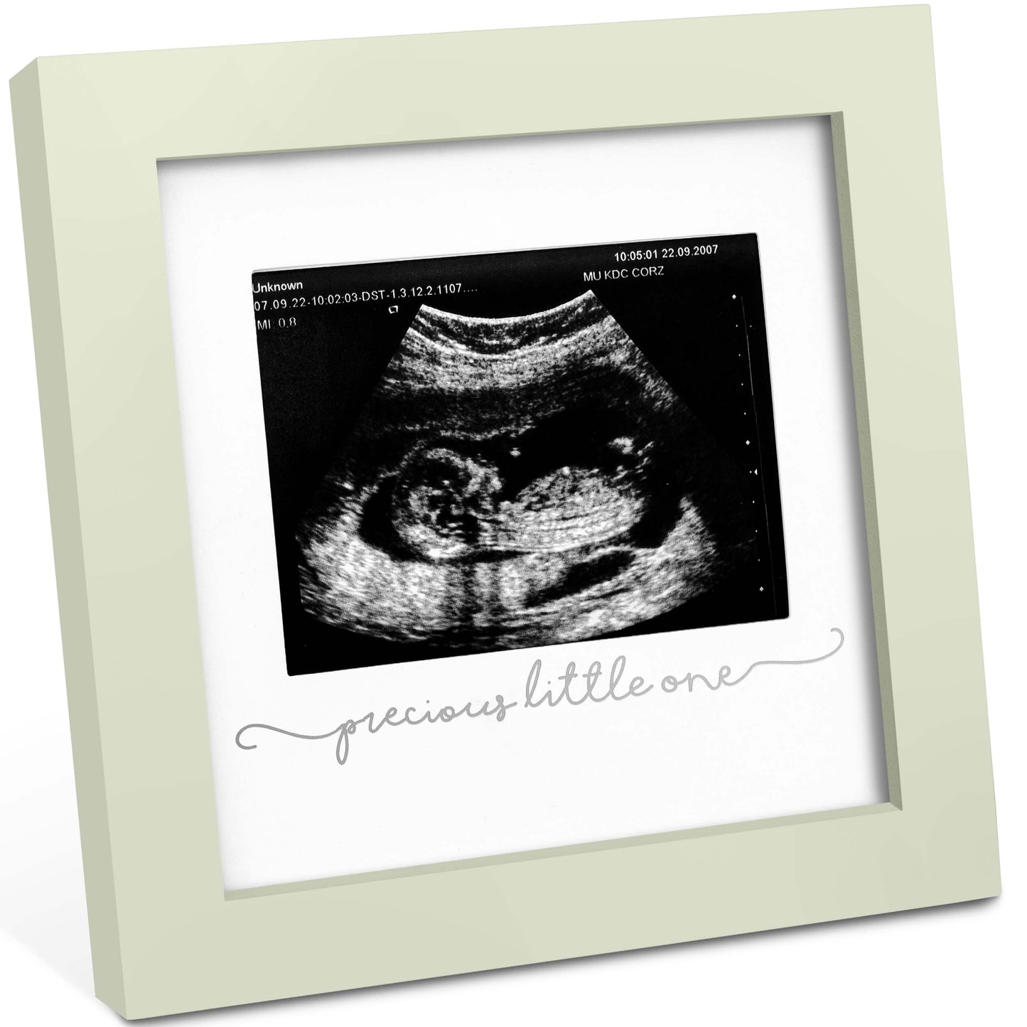 Solo Baby Sonogram Frame 28694476488890