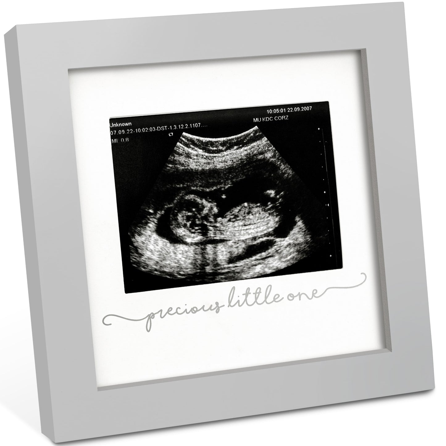 Solo Baby Sonogram Frame 27273225470138