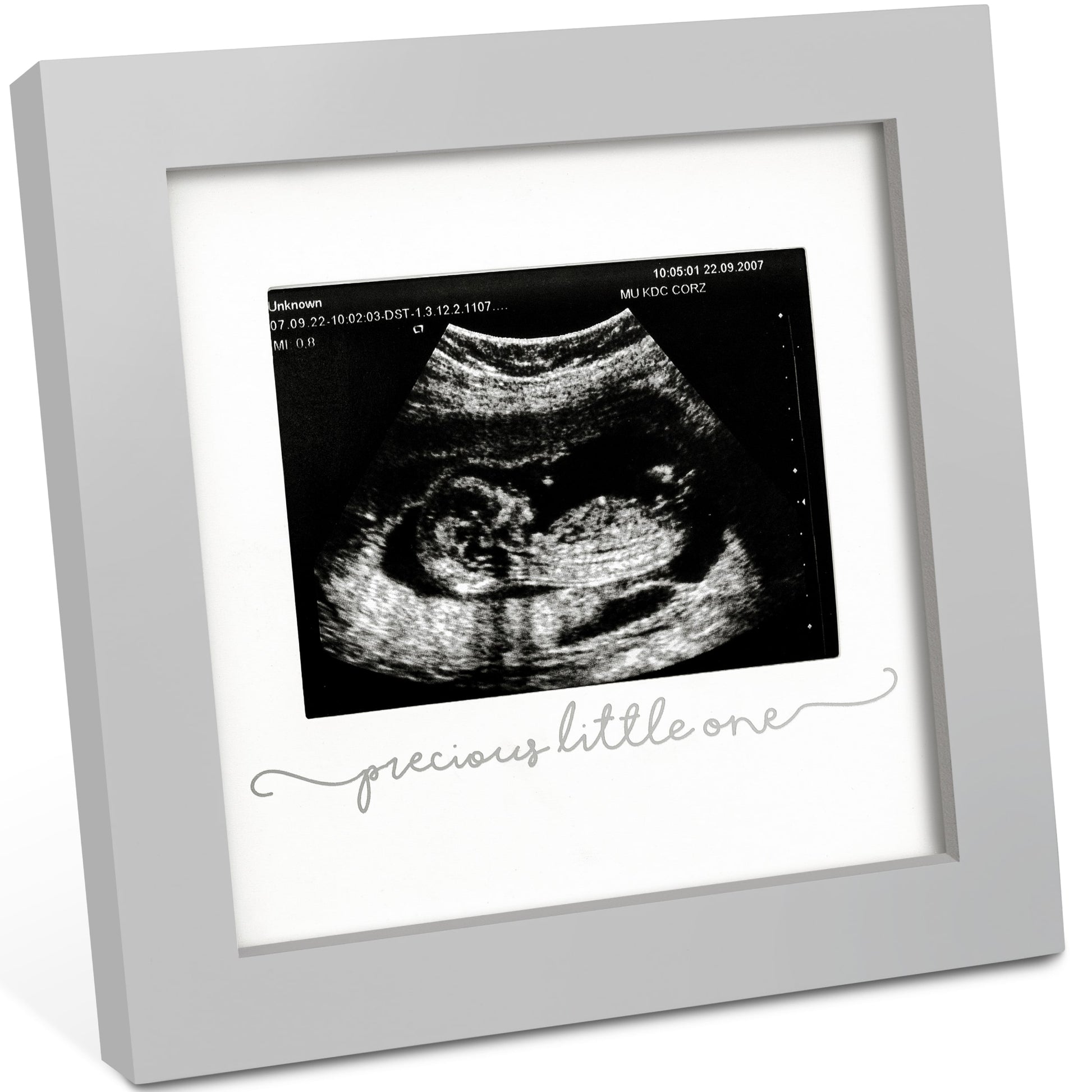 Solo Baby Sonogram Frame 27273225470138