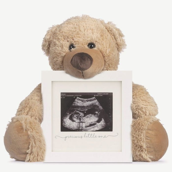 Sonogram Frames