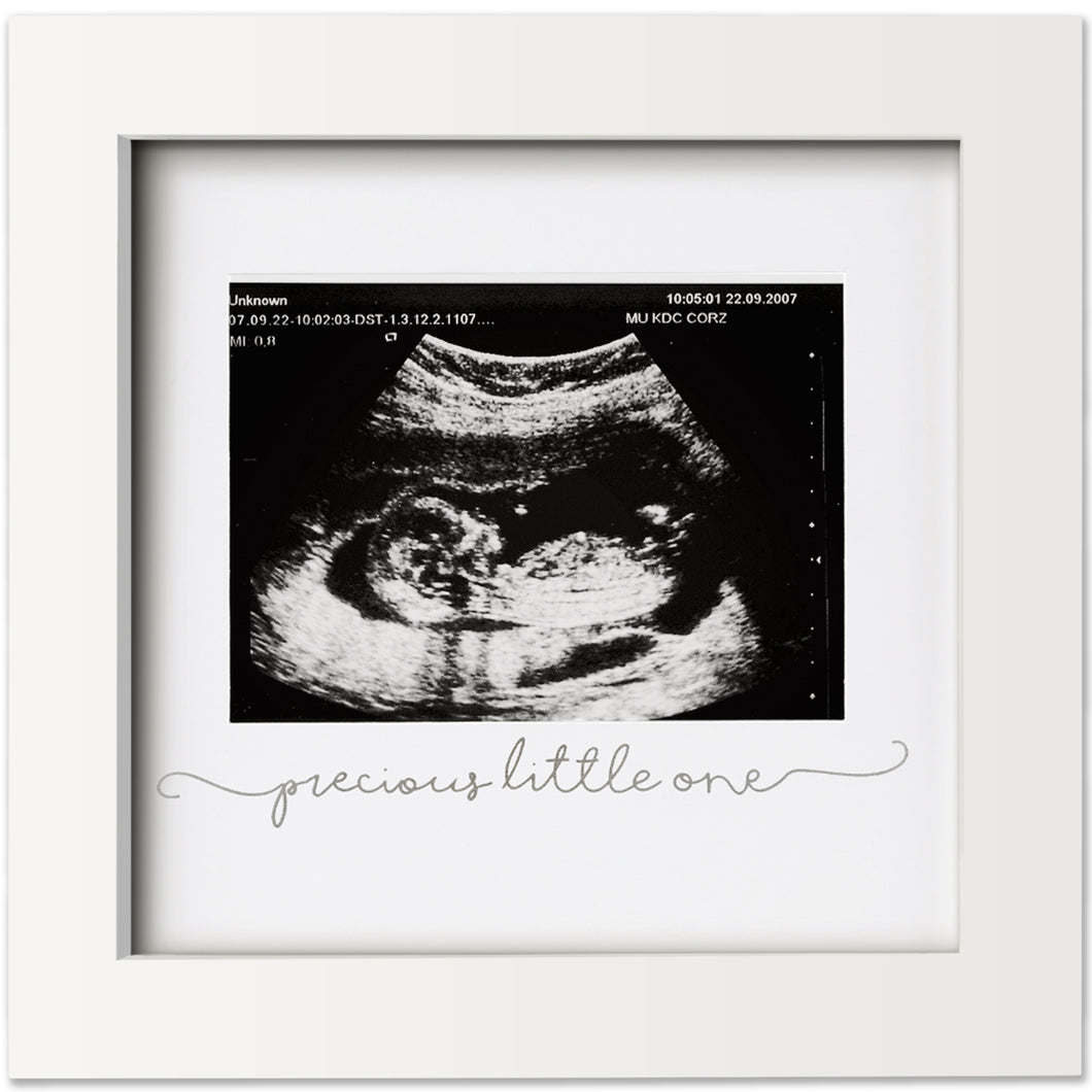 Solo Baby Sonogram Frame